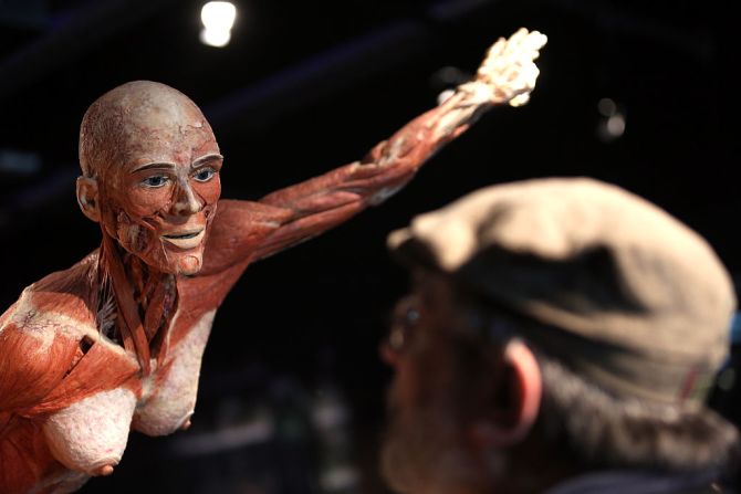 Si fuiste a la exposición Body Worlds, sabes lo que es la plastinación, el proceso de posar y endurecer el cuerpo para que parezca vivo.