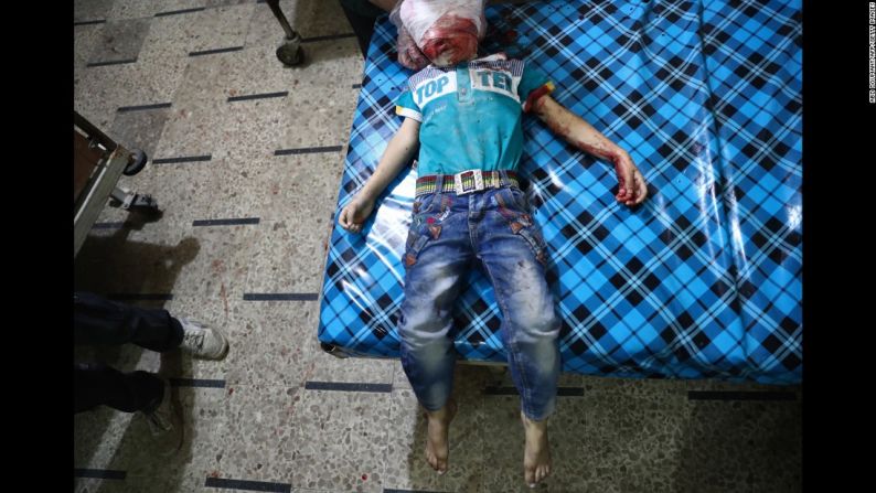 Bombardeo en Siria — El cuerpo de un niño reposa en un improvisado hospital en Siria luego de un bombardeo en la ciudad de Douma este lunes 24 de octubre. A principios de este año el enviado especial de las Naciones Unidas estimó que unos 400.000 sirios han muerto desde que la guerra civil inició en abril de 2011.