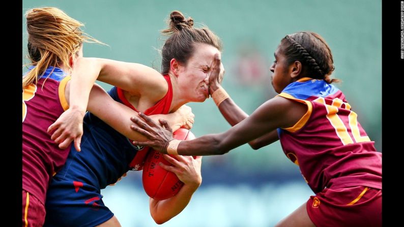 La jugadora del Melbourne Daidy Pearce le pone una mano en la cara a una rival durante un partido de la Liga Australiana de Fútbol el domingo 22 de mayo.