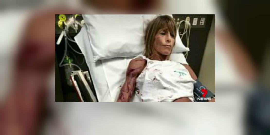 Debbie Urquhart en su lugar de convalecencia en Sidney. (Cortesía Seven News).