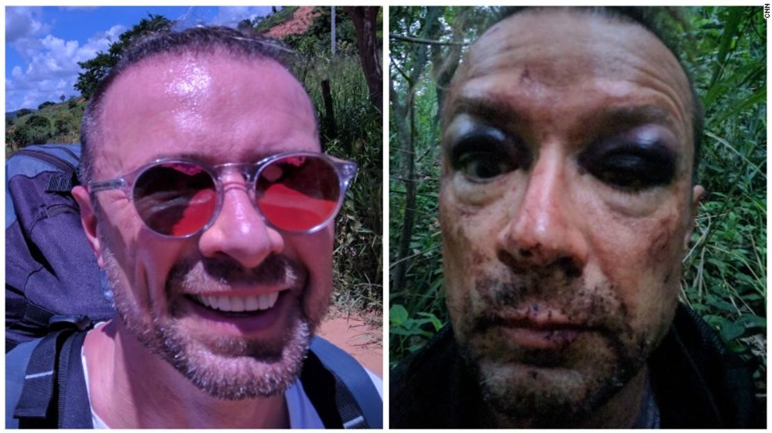 Thomas Antalffy despertó en medio de la selva y no recordaba cómo cayó desde su parapente. Tomó esta selfie y días después descubrió la gravedad de sus heridas.