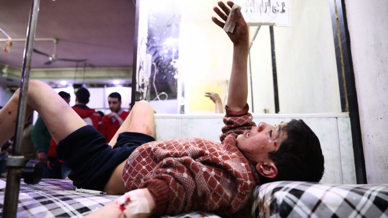 TOPSHOT - EDITORS NOTE: Graphic content / A wounded Syrian youth gestures at a makeshift clinic following reported air strikes by government forces in the rebel-held town of Douma, on the eastern outskirts of Damascus, on April 3, 2017.
Air strikes by Syrian warplanes on a rebel-held region near Damascus killed at least 22 civilians, the Syrian Observatory for Human Rights monitor said. / AFP PHOTO / Abd Doumany