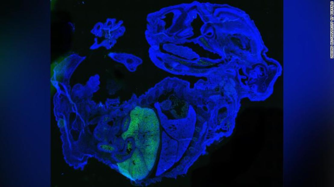 La imagen muestra una gran cantidad de células humanas (en verde) en un embrión de ratón de 17 días (en azul). La mayoría de las células humanas son glóbulos rojos, que están acumuladas en el hígado fetal del ratón.