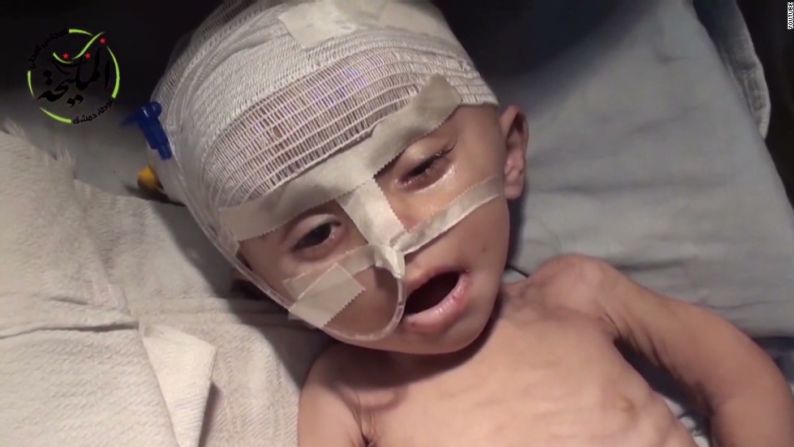 Israa al Masri muere de hambre en un hospital de Siria en 2014. La escasa comida y medicamentos hacen que los niños sufran en los hospitales. Esta bebé murió el 12 de enero de 2014.