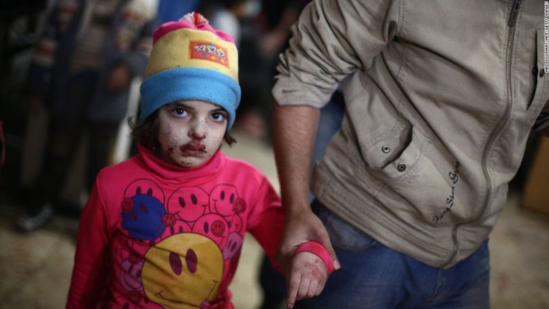 Un niña herida camina hacia un hospital de emergencia en el pueblo de Douma, controlado por los rebeldes, el 23 de diciembre de 2014.