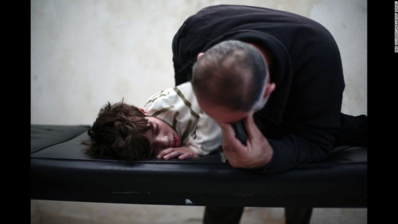 Un padre llora sobre su hijo en un centro de terapia física a las afueras de Damasco. El niño se cortó los tendones de las piernas durante un bombardeo meses antes.