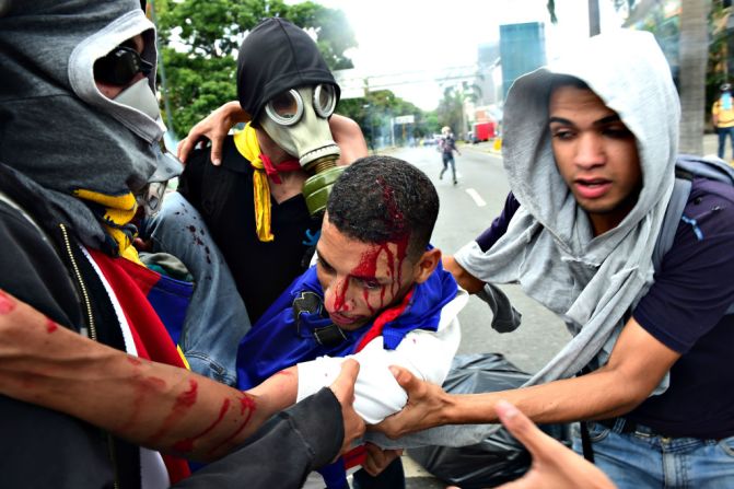 Un manifestante de la oposición herido es llevado por sus compañeros en medio de los fuertes disturbios y la represión que sufrieron las marchas este 26 de abril en Caracas.