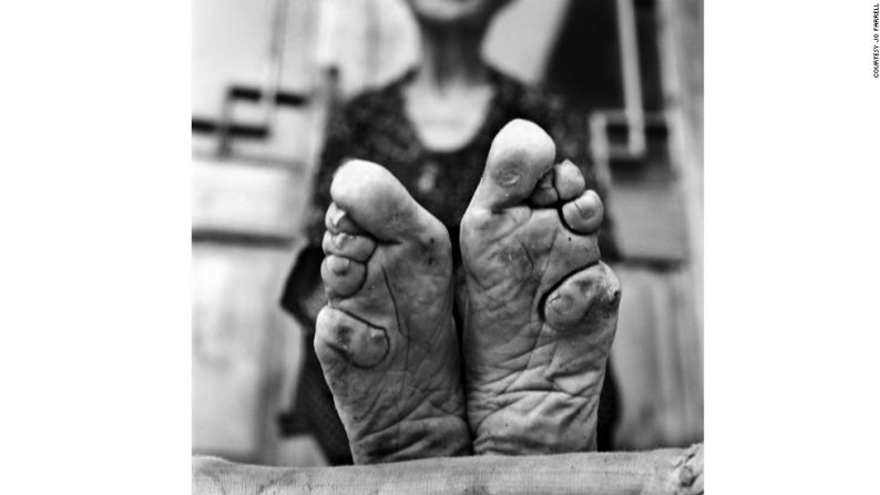 Jo Farrell es una fotógrafa radicada en Hong Kong que se enfoca en retratar costumbres femeninas que ya no están vigentes. Durante ocho años se dedicó a capturar imágenes de 50 mujeres con los pies vendados en el área rural de China. Aquí vemos los pies de Zhao Hua Hong, en el lente de Farrell.