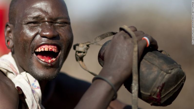 Malteada de sangre: los samburú, en Kenya, usan la sangre del ganado como una bebida nutritiva. La mezclan con leche.