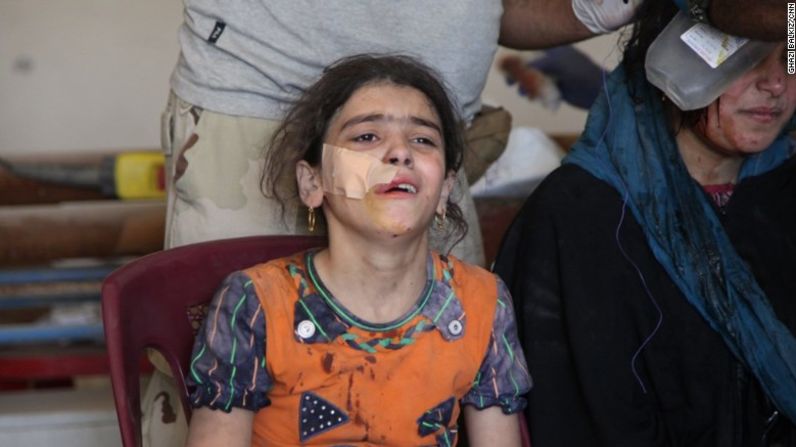 Mairam Salim de 10 años llora mientras es atendida en una clínica provisional al oeste de Mosul. Estaba tratando de huir con sus familiares este 4 de junio, cuando su casa colapsó a raíz de una explosión. La mayoría de su familia está enterrada bajo los escombros de lo que era su hogar.