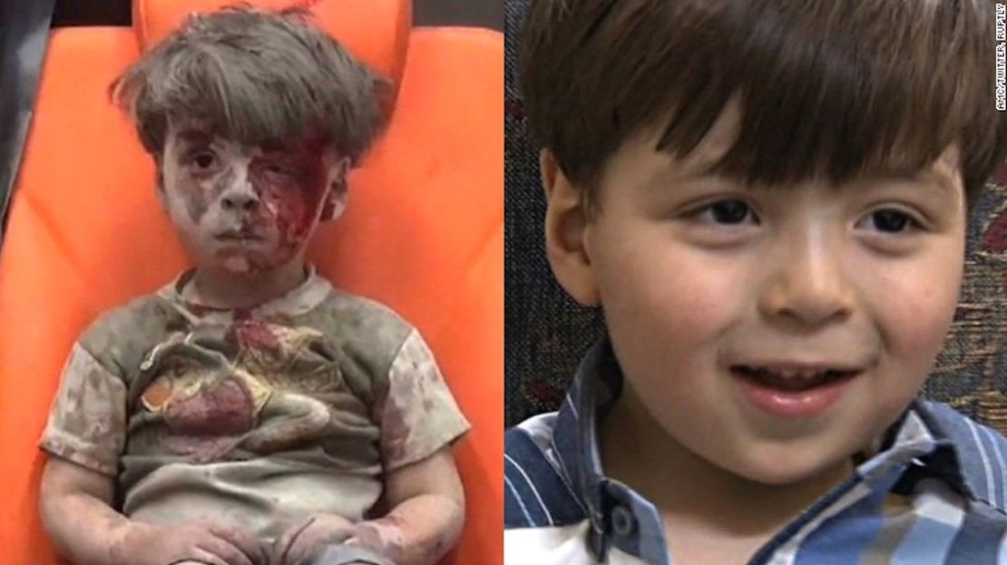La imagen de Omran Daqneesh tomada en agosto de 2016 vs. cómo apareció en la televisión estatal siria en junio de 2017.