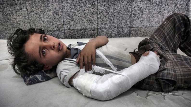 Después de dos años y medio de guerra civil, un brote de cólera y una brutal hambruna en Yemen crearon una de las peores crisis humanitarias del planeta.