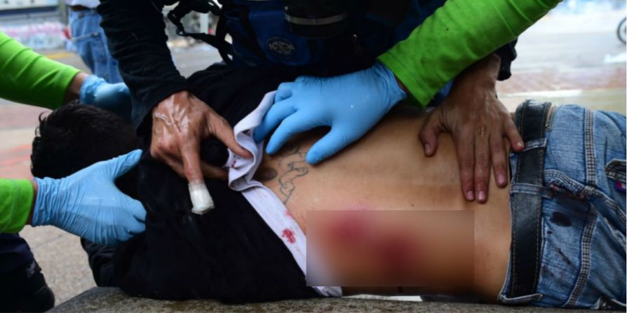 Un manifestante opositor herido es atendido por paramédicos durante una manifestación en contra de la Asamblea Nacional Constituyente en Caracas este 30 de julio del 2017.