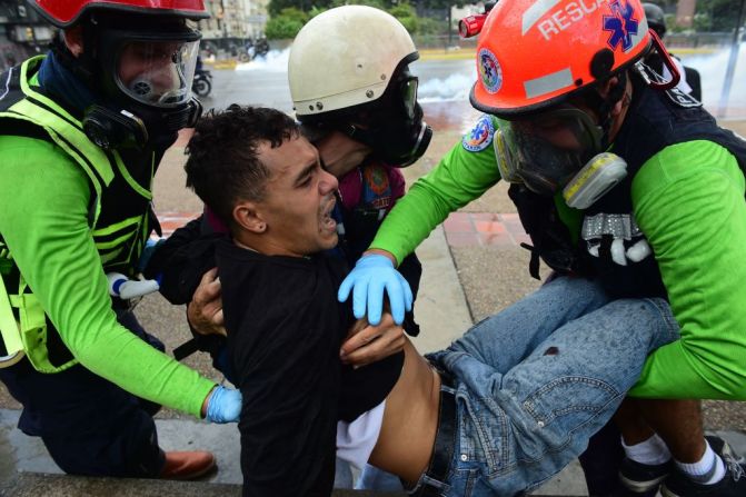 Un manifestante opositor herido es atendido por paramédicos durante una manifestación en contra de la Asamblea Nacional Constituyente en Caracas este 30 de julio del 2017. En algunas calles de la capital de Venezuela se observan manifestantes y policías enfrentados entre bombas improvisadas, gas lacrimógeno y perdigones.