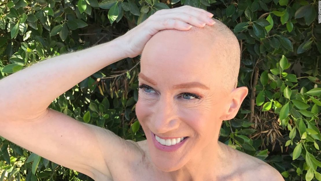 CNNE 436190 - kathy griffin cabeza afeitada cambio de look cancer