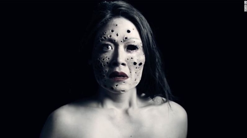 Esta publicidad de “American Horror Story: Cult” parece usar vainas de loto para recrear este efecto en la piel de la mujer. La protagonista de la serie, Ally Mayfair Richards (interpretada por Sarah Paulson) sufre de tripofobia.