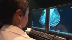 Según la OPS, el cáncer de mama es el que más afecta a las mujeres en Latinoamérica.