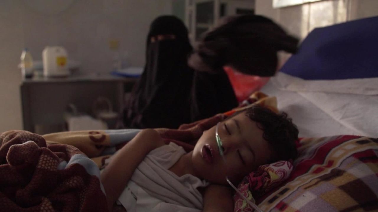 CNNE 477298 - yemen nino enfermo