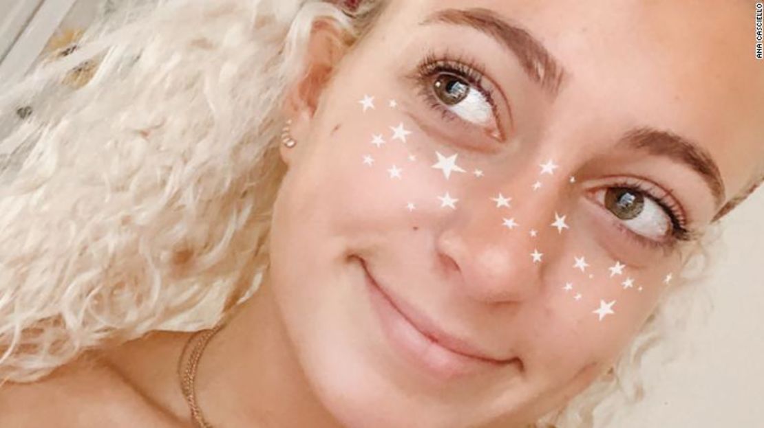 Casciello usando su filtro que les pone pecas con forma de estrellas a los usuarios.