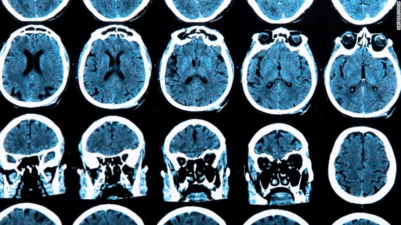 2012: Un estudio publicado dio crédito a la teoría de que los alimentos y los carbohidratos azucarados dañan la salud del cerebro.