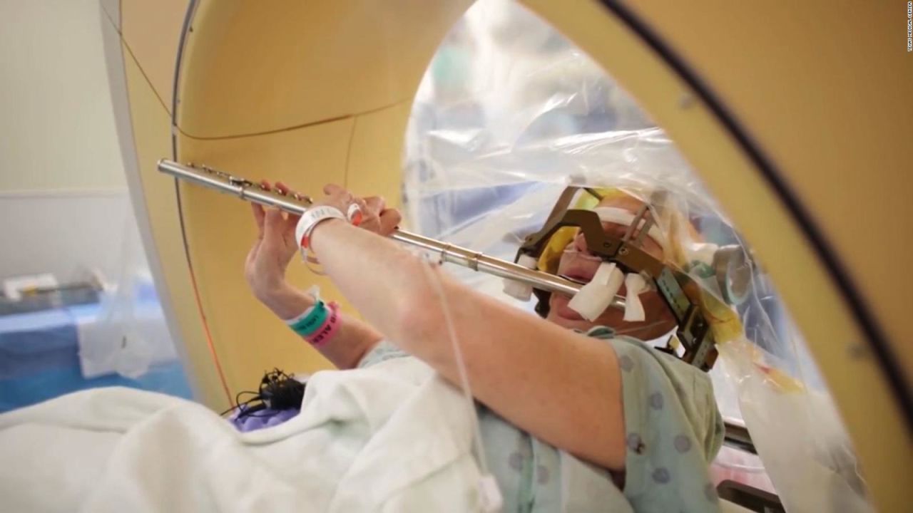 CNNE 510693 - esta mujer toco la flauta mientras le operaban el cerebro