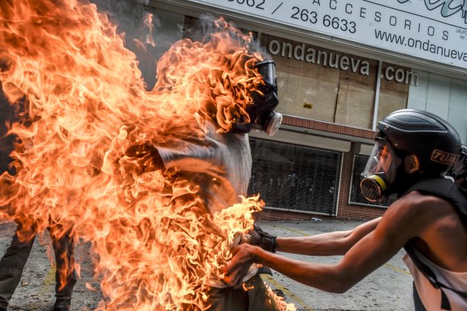 El caso se dio cuando explotó el tanque de gasolina de una motocicleta. (Crédito: