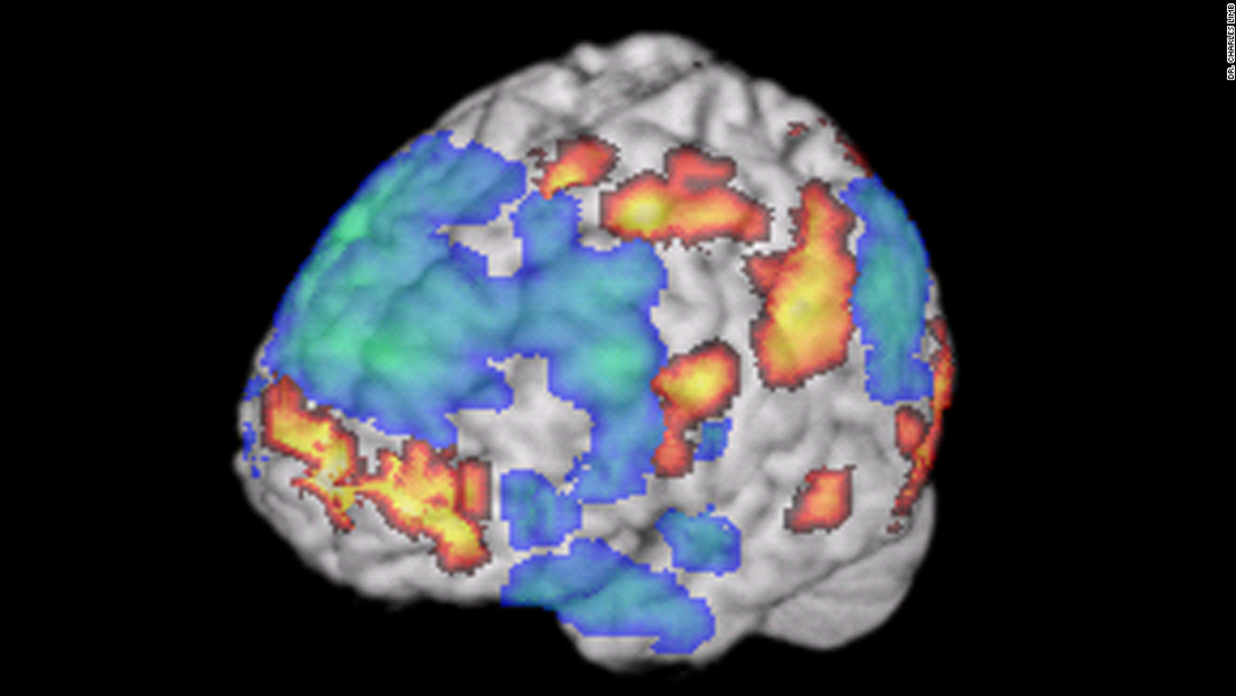 La corteza prefrontal media, parte del cerebro que permiten a los humanos expresarse, se muestra en amarillo. La parte responsable de la autoinhibición y control, la corteza prefrontal dorsolateral, en azul.