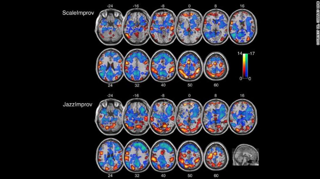 Así reacciona el cerebro de los músicos mientras tocan música improvisada.