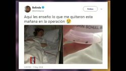 CNNE 522257 - lo que le quitaron a belinda en una operacion de emergencia