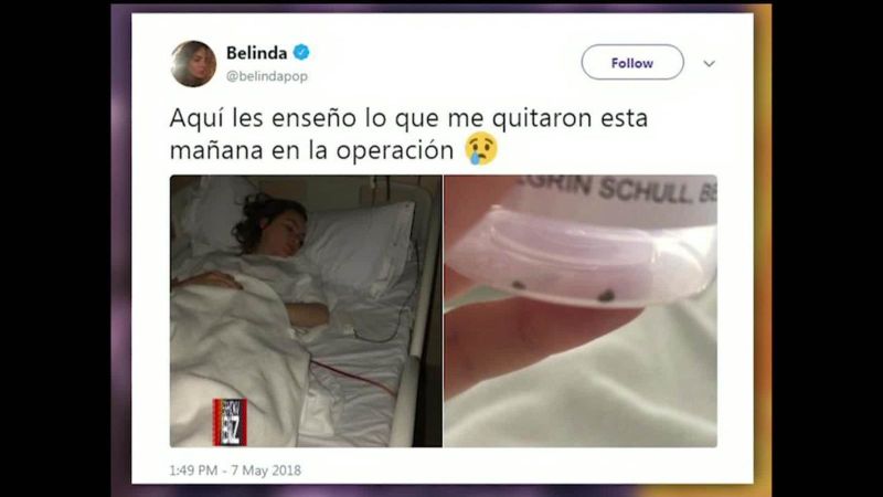 Belinda se recupera de la operación de emergencia que la llevó a cancelar un concierto