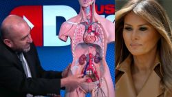 CNNE 523907 - ¿como es la cirugia que le hicieron a melania trump?