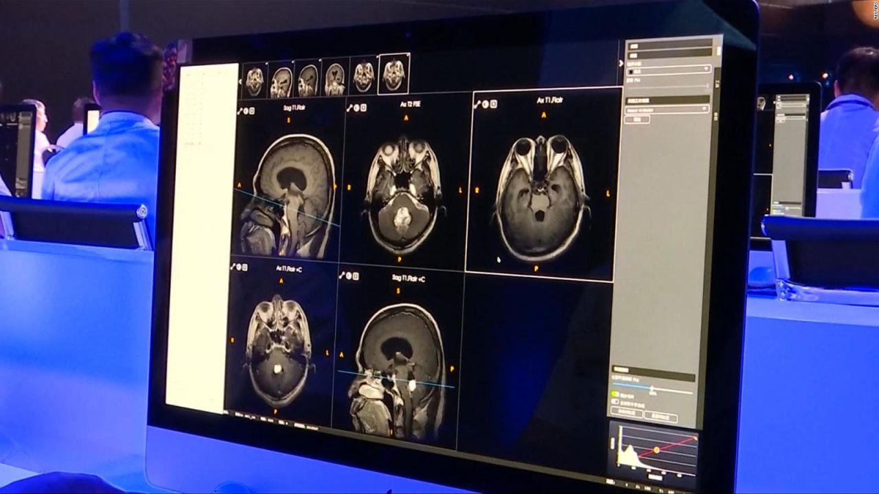 CNNE 540045 - sistema de inteligencia artificial le gana a grupo de doctores