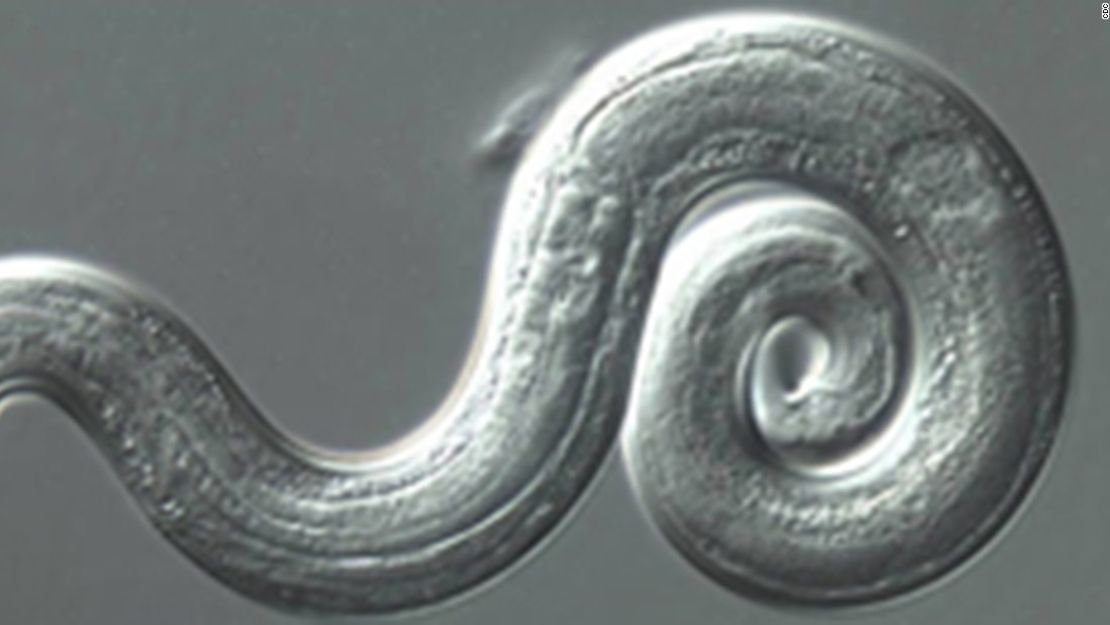 Imagen microscópica del parásito conocido como gusano pulmonar de rata.