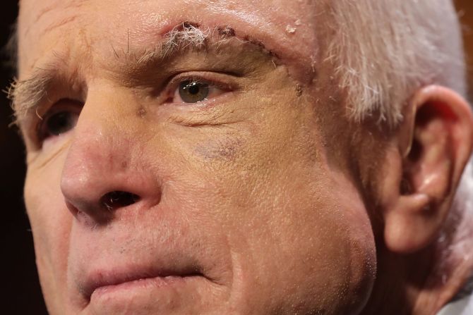 Menos de dos semanas después de que los cirujanos extirparon un gran coágulo de sangre de su cerebro y lo diagnosticaron con cáncer cerebral, McCain regresó al Senado en julio de 2017. Recibió una gran ovación de ambos partidos.