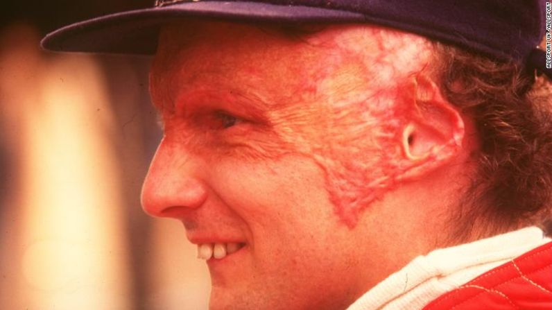 Niki Lauda, tres veces campeón del mundo, sufrió graves quemaduras en la cabeza e inhaló gases tóxicos que dañaron sus pulmones tras un choque en Nürburgring en 1976. El incidente ocurrió en un punto del circuito de 22,8 kilómetros al que era casi imposible llegar, y Lauda tuvo que ser sacado por cuatro colegas pilotos. Tras el accidente, el circuito de Nürburgring fue retirado de calendario en la siguiente temporada.