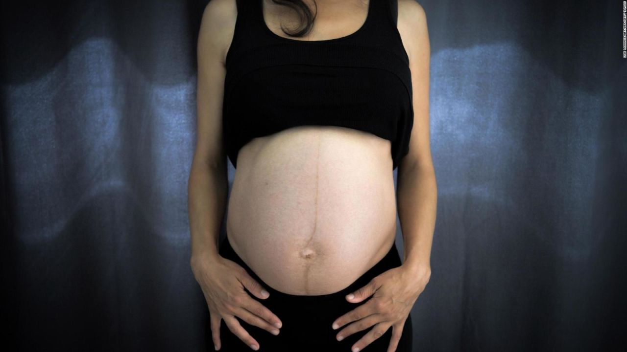 CNNE 569732 - contaminacion podria afectar desarrollo de fetos
