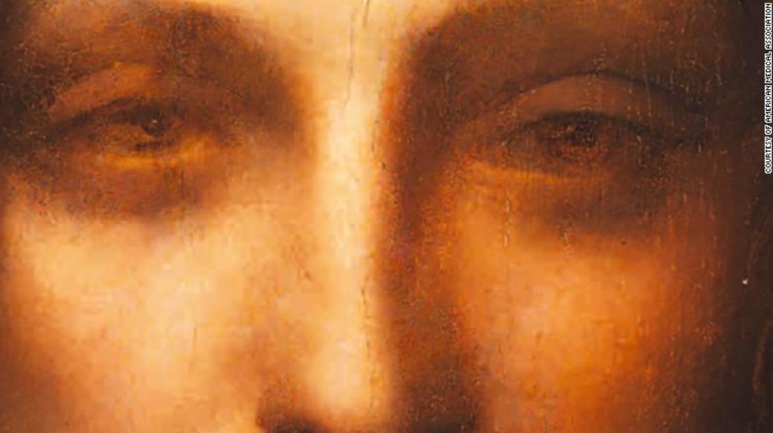 CNNE 579409 - 181018132733-01-rare-eye-condition-helped-da-vinci-paint-intl-exlarge-169