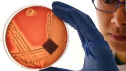 CNNE 587813 - superbacterias inmunes a los antibioticos en europa