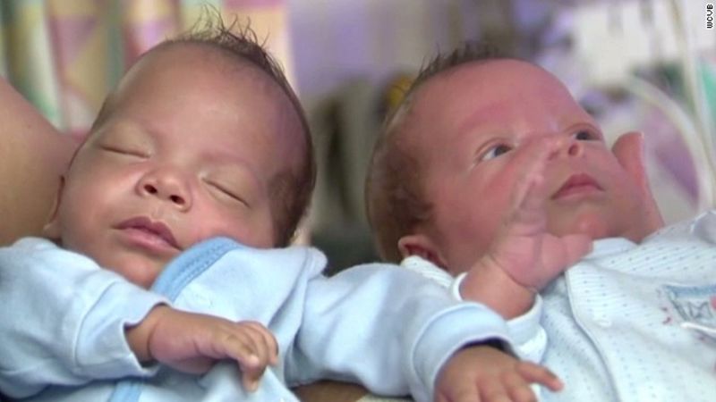 Gemelos idénticos nacen con una diferencia de… 24 días | cnn