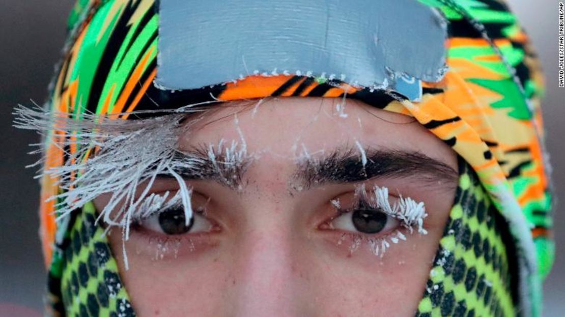 Escarcha de hielo cubre parte del rostro de un estudiante de la Universidad de Minnesota.