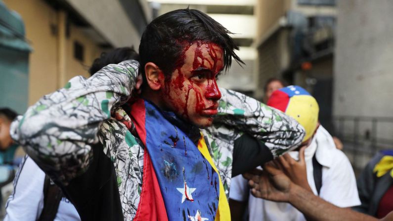 Un manifestante herido en Caracas el 23 de enero de 2019. (Miguel Gutiérrez / EPA-EFE).