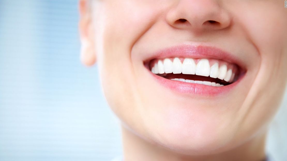 CNNE 635336 - sonrisa-dientes-blancos