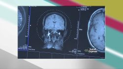 CNNE 640757 - ¿cuales son los riegos derivados de las radiografias?