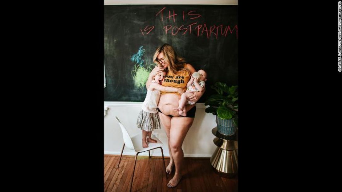 CNNE 648463 - this-is-postpartum-ashley-posparto