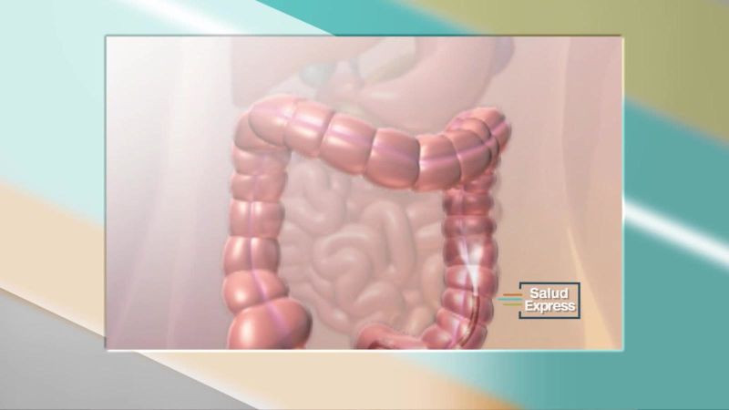 ¿qué es el trasplante fecal y cómo funciona? | cnn