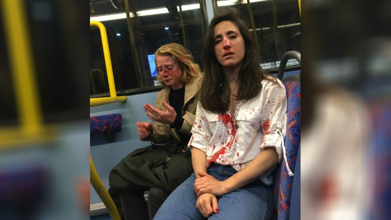 30 de mayo: Melania Geymonat y su pareja Chris ensangrentadas después de ser golpeadas en un ataque homofóbico dentro un autobús de Londres. La Policía Metropolitana dijo que cuatro hombres, entre los 15 y 18 años, fueron arrestados bajo sospecha de robo y de causar lesiones corporales graves. Posteriormente, fueron acusados ​​de delito de odio agravado bajo la Ley de Orden Público. El alcalde de Londres, Sadiq Khan, condenó el incidente y dijo que fue un “ataque repugnante y misógino”. En agosto, los sospechosos se declararon inocentes de un cargo de acoso con uso palabras o comportamientos amenazantes o abusivos.