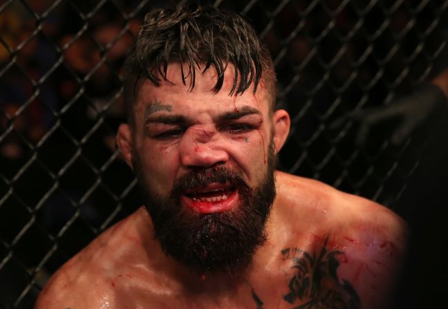 La nariz de Mike Perry quedó desfigurada durante su pelea de UFC contra Vicente Luque el 10 de agosto. Luque ganó el combate por decisión dividida. Alexandre Schneider / Zuffa / Getty Images