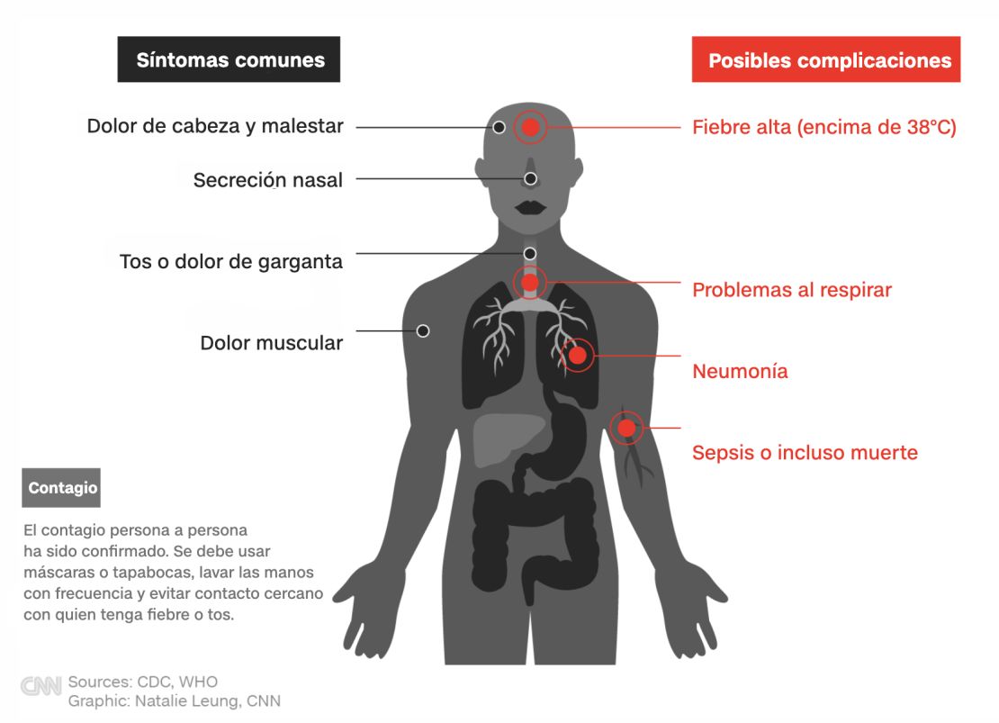 CNNE 775301 - sintomas coronavirus