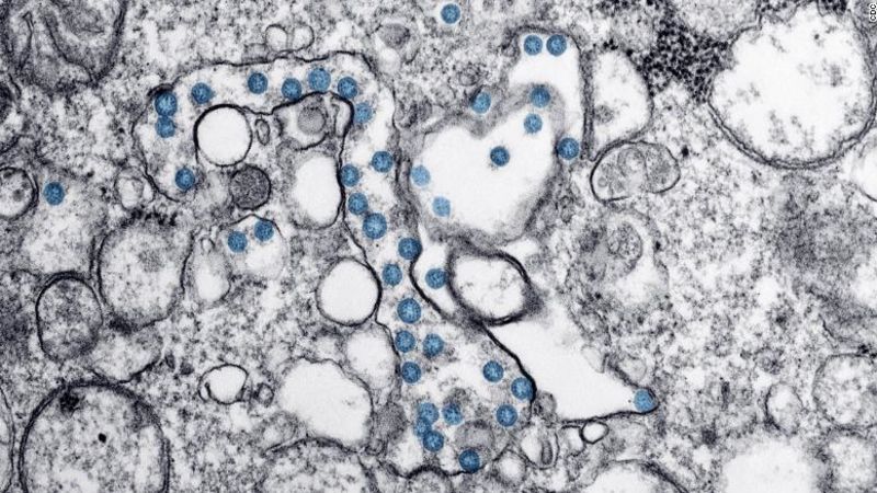 ¿qué significa que la oms haya declarado pandemia al coronavirus? Lo que debes saber | cnn