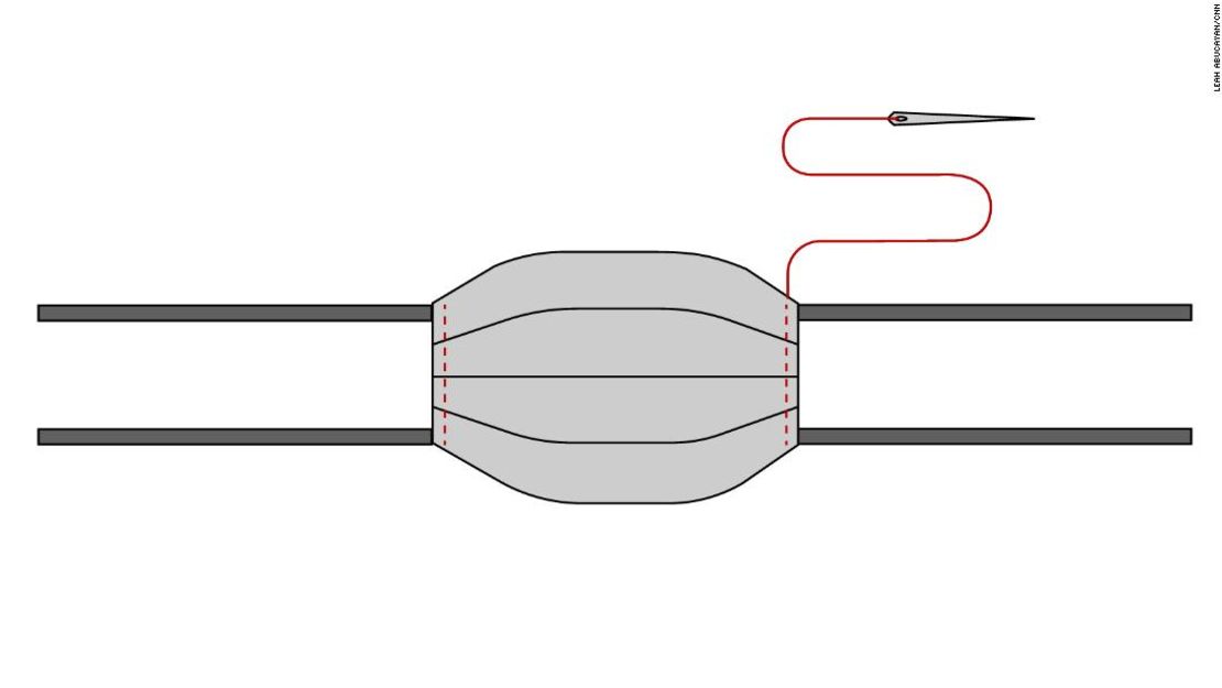 Corta cuatro tiras de tela, de 2 pulgadas (5 cm)  de ancho por 16 pulgadas (40 cm) de largo. Dobla por la mitad a lo largo. Gíralos debajo de 1/4-pulgada (0,6 cm) en el lado largo. Plánchalos en su lugar, luego cose el lado largo cerrado. Marca cada unión a una esquina de la máscara. Cose alrededor del perímetro de la máscara una vez más para que se unan los lazos, y ya completaste tu máscara.